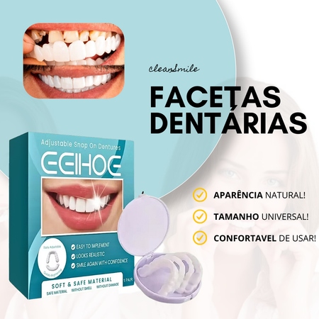 CleanSmile Facetas Dentarias Naturais Removíveis